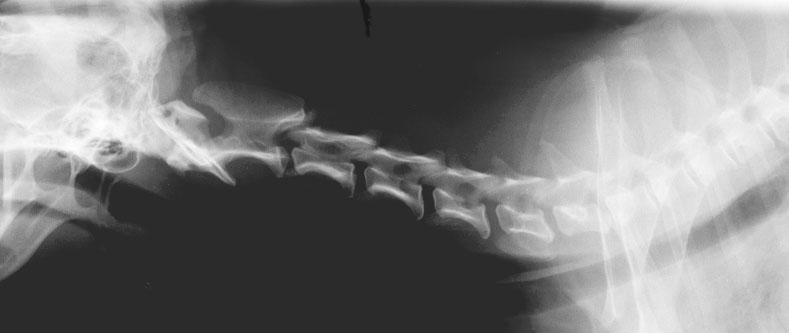 Spine normal cervical - radiograph lateral