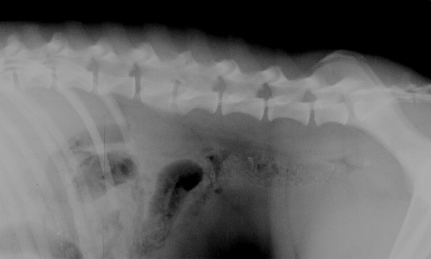 Spine block vertebrae - radiograph lateral
