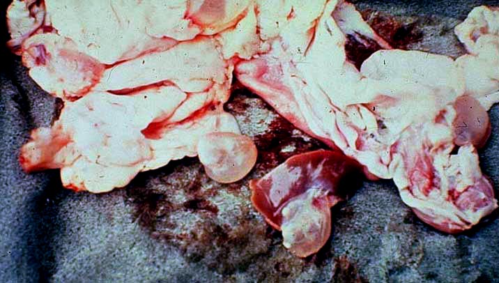 Taenia hydatigena metacestode (cysticercus) from sheep peritoneal cavity 01