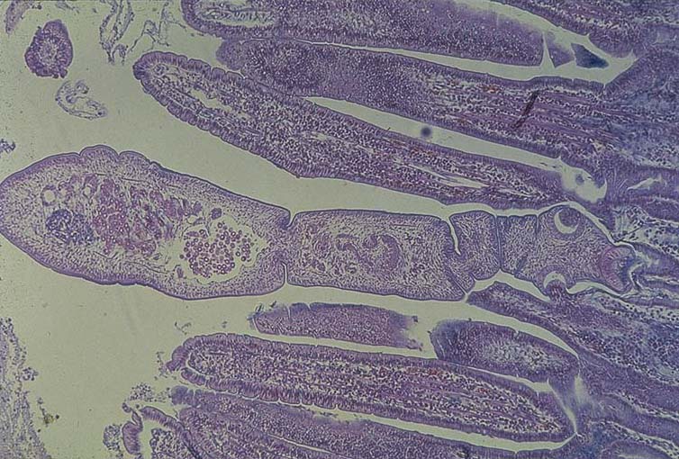 Echinococcus granulosus adult embedded within intestinal villi