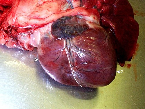 Post-mortem 19: examine heart