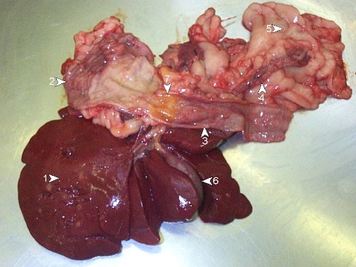 Post-mortem 25: examine duodenum/stomach/liver