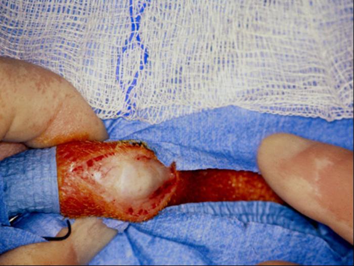 Closed castration 03 - incision into subcutaneous tissue over the testicle