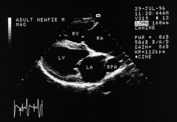 Pulmonary hypertension 01: right long axis ultrasound