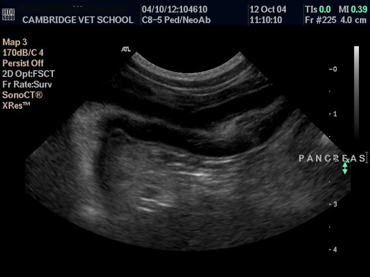Pancreas: normal - ultrasound