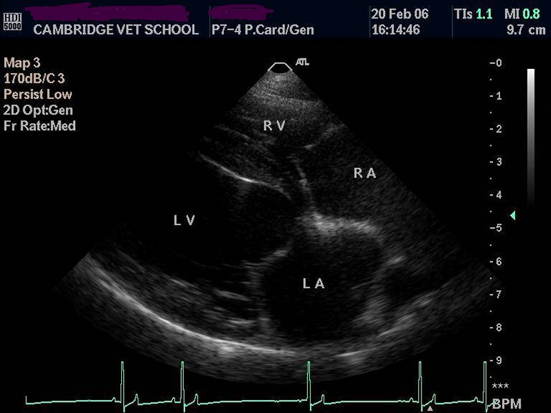 Heart: normal right 4-chamber view – ultrasound
