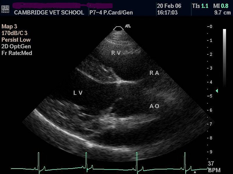 Heart: normal 5-chambered view for aorta 01 - ultrasound