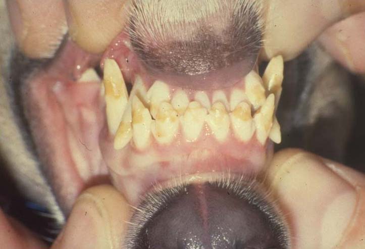 Teeth enamel hypoplasia as per (17)
