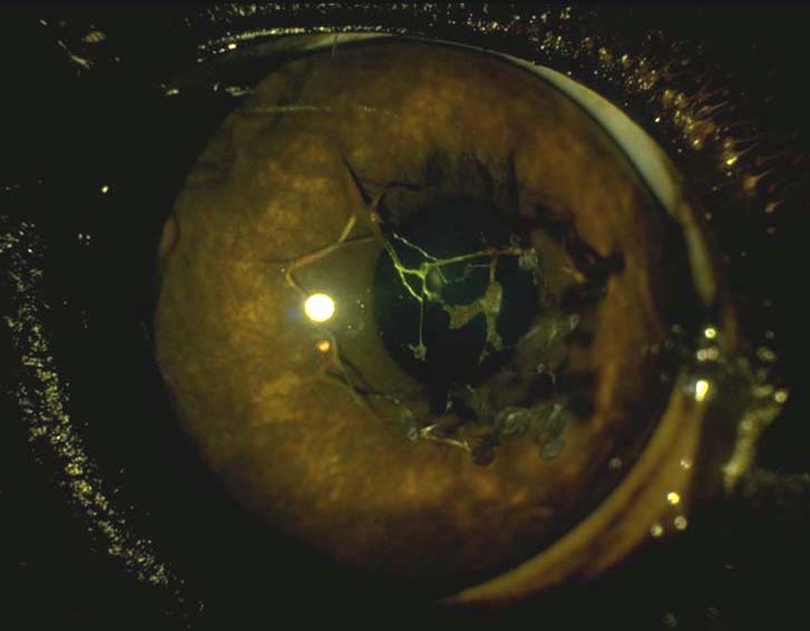 Persistent pupillary membrane Labrador 6 months