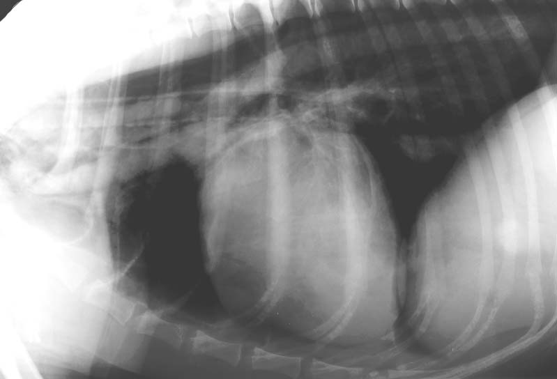 Thorax pneumomediastinum - radiograph lateral