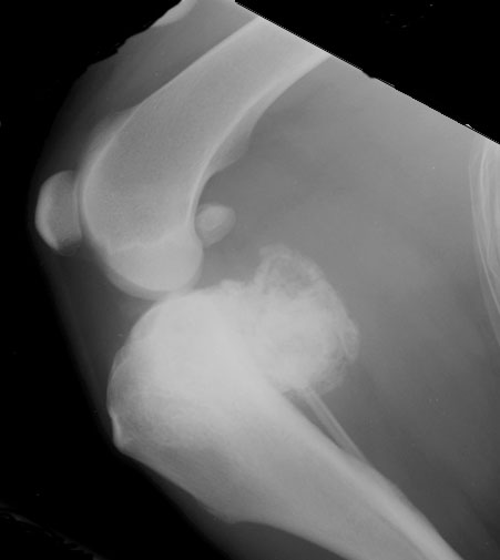 Stifle parosteal osteosarcoma - radiograph lateral