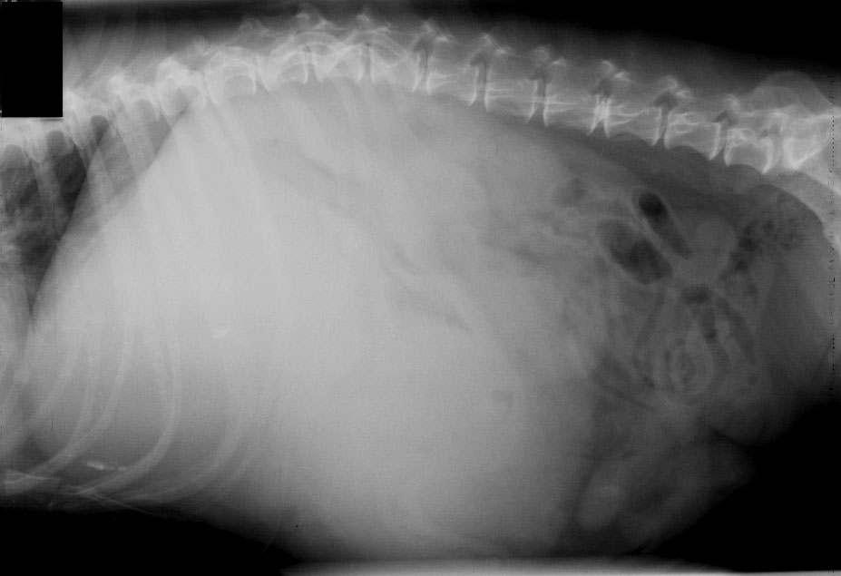 Abdomen hepatomegaly (tumor) - lateral radiograph