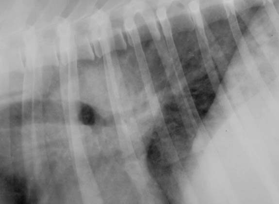 Lung interstitial pattern (close-up) - radiograph