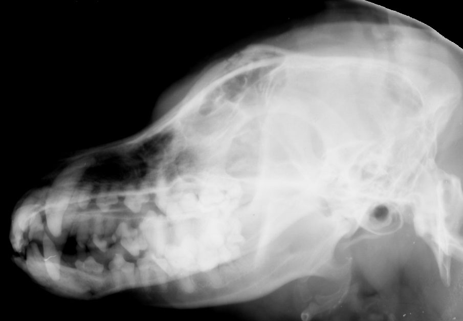 Skull frontal bone fracture - radiograph lateral oblique