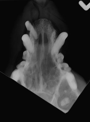 Skull oligodontia - radiograph intra-oral