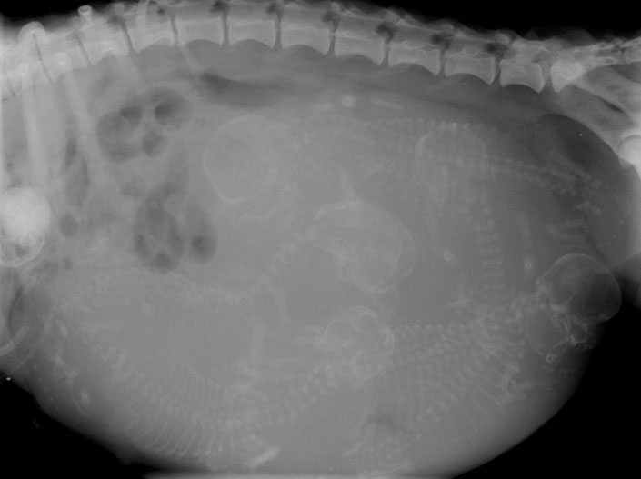Abdomen fetal ossification - radiograph lateral