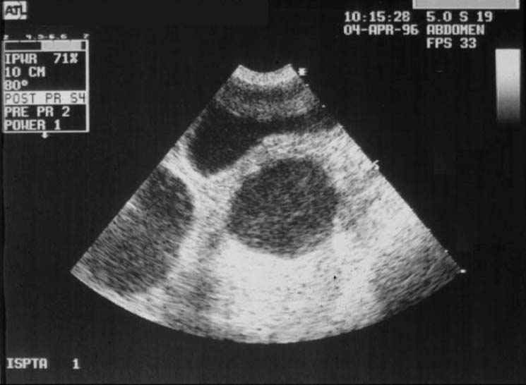Uterus pyometra - ultrasound