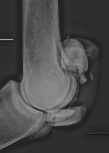 Proximal sesamoid: fracture 20 comminuted - LM radiograph