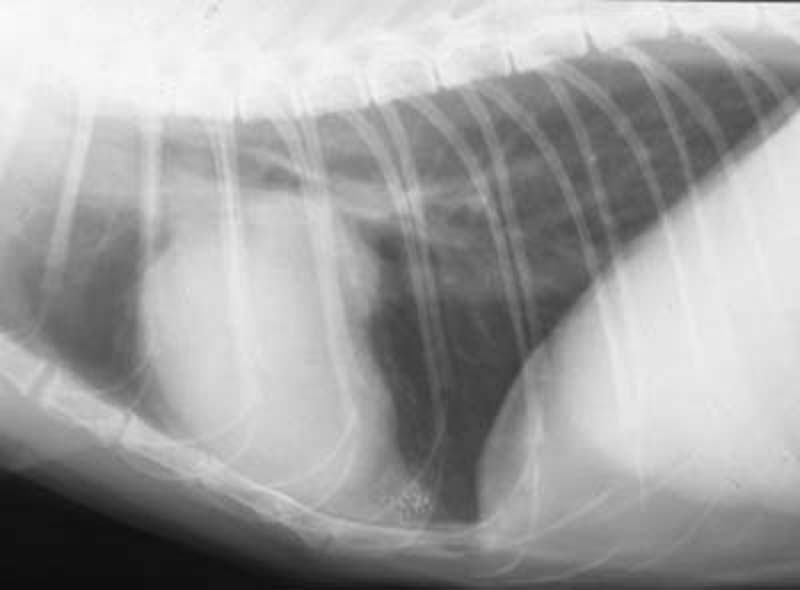 Heart: hypertrophic cardiomyopathy 04 - radiograph lateral