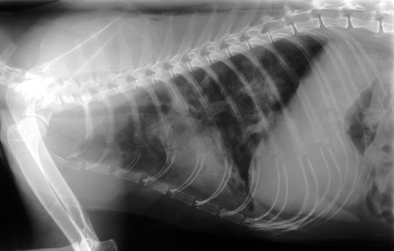 Lung: pneumonia - radiograph lateral