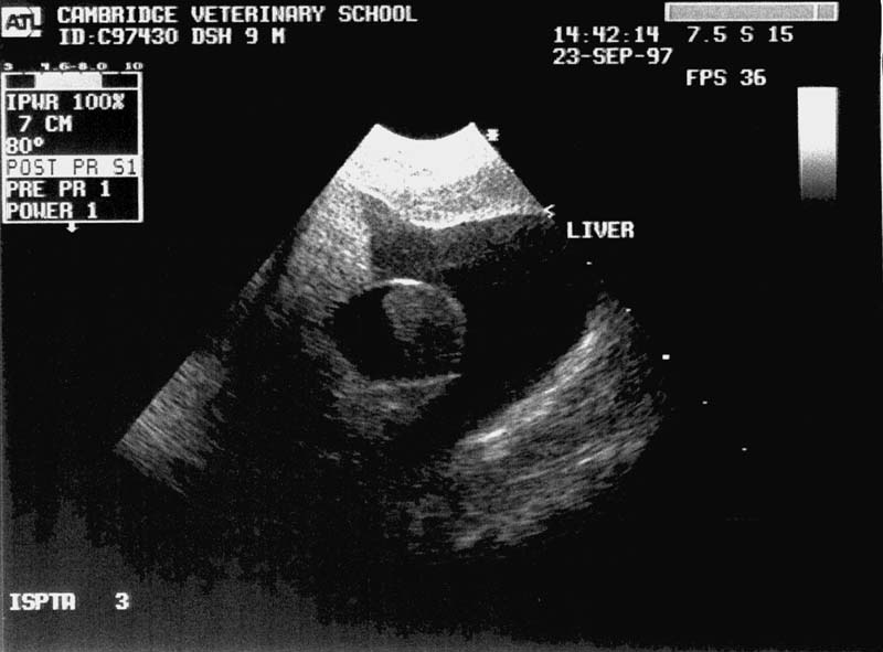 Abdomen: ascites - DV ultrasound