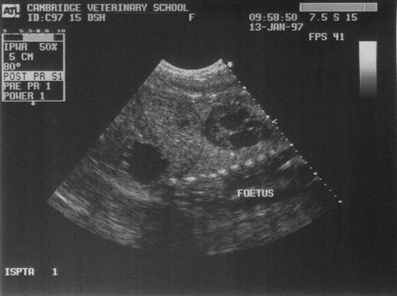 Abdomen: normal pregnancy - ultrasound 02