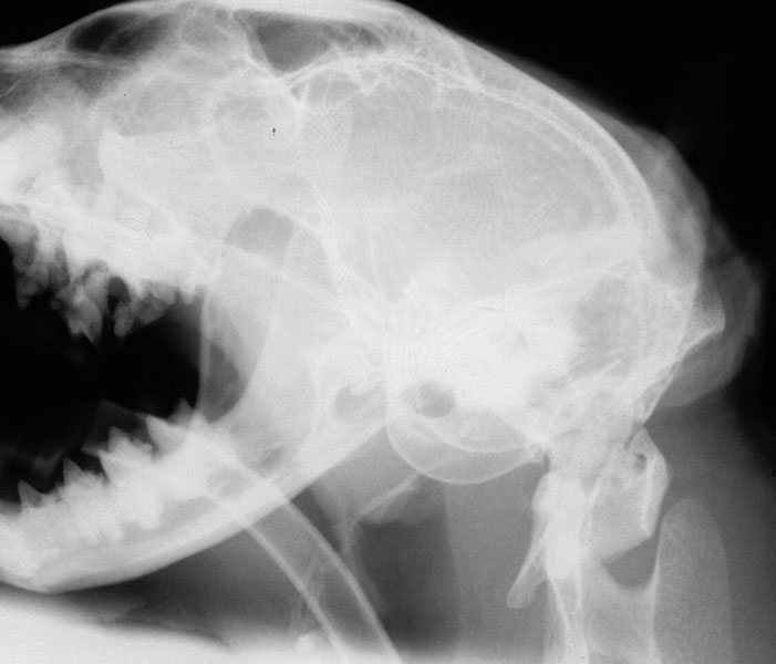 Skull: nasopharyngeal polyp - radiograph lateral pharynx