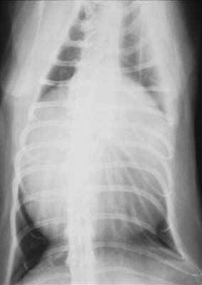 Thorax: pericardioperitoneal hernia - radiograph DV