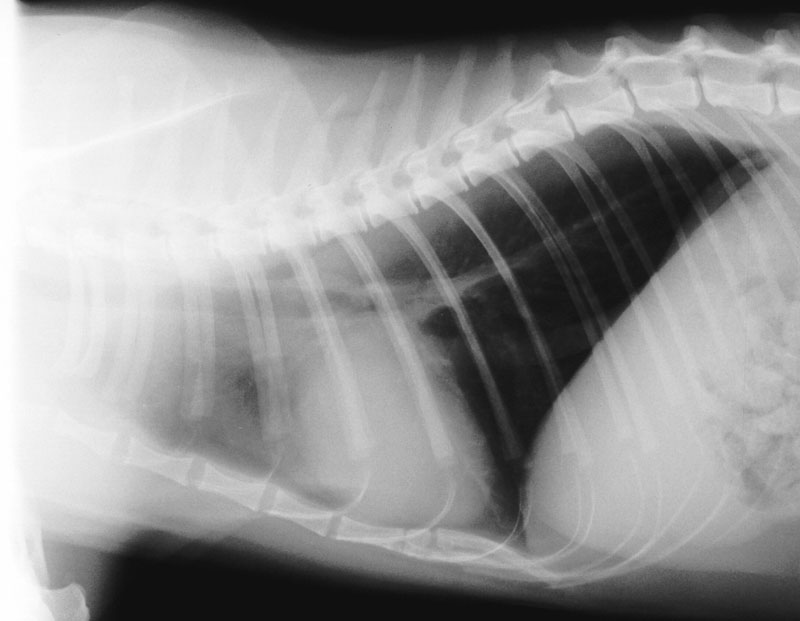 Heart: hypertrophic cardiomyopathy 02 - radiograph lateral