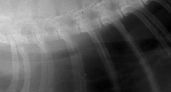 Trachea: mass radiograph lateral