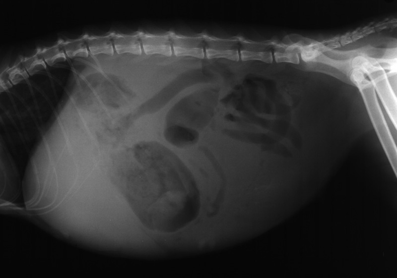 Liver: portal hypertension - radiograph lateral