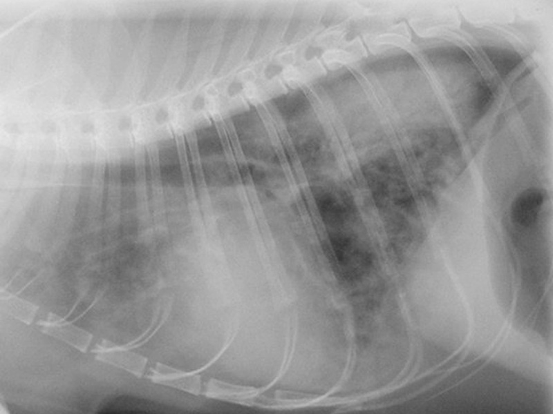 Lung: pulmonary edema lateral radiograph