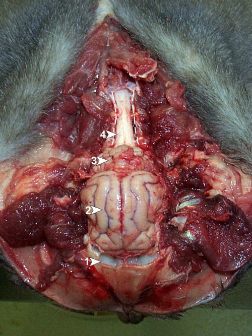 Post-mortem (31): exposure of frontal sinuses