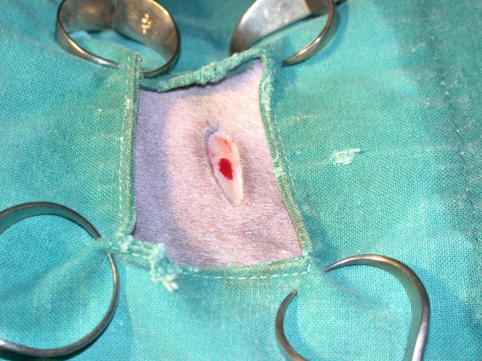 Ovariohysterectomy 04: skin incision