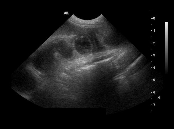 Abdomen: closed pyometra - ultrasound