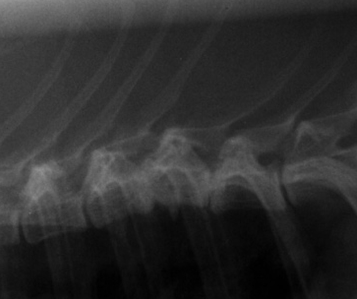 Vertebra: thoracic fracture lateral radiograph