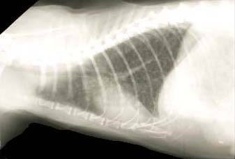 Lung: interstitial pattern - radiograph