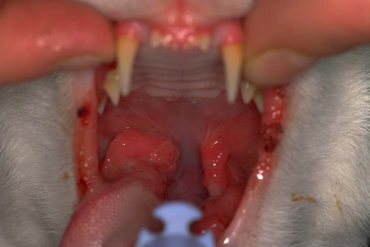 Mouth: gingivitis - hyperplastic plasmacytic