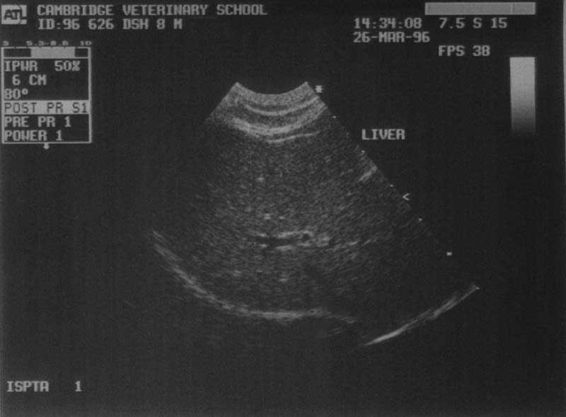 Liver: normal - ultrasound