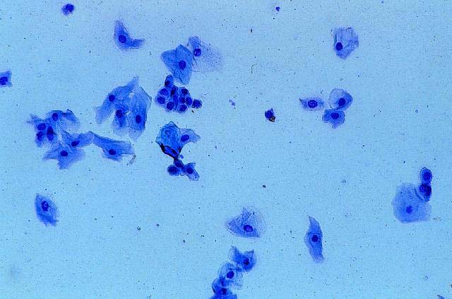 Cytology: vaginal cytology from diestrus queen