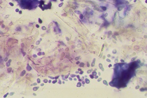Malassezia dermatitis: cytology