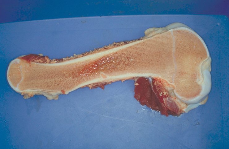 Bone marrow: Fell pony immunodeficiency syndrome - pathology