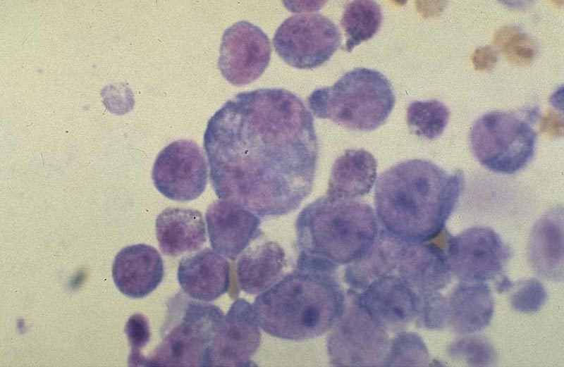 Cytology lymphoma