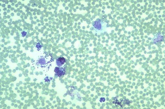 Cytology mast cells - intra-abdominal mast cell tumor